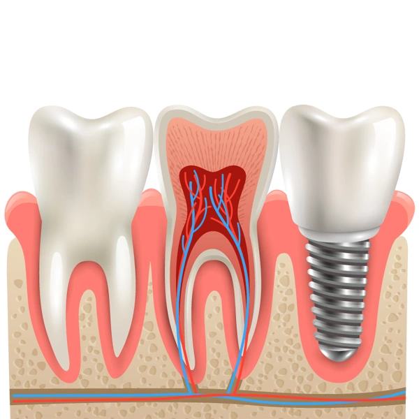 implant dentistry small image