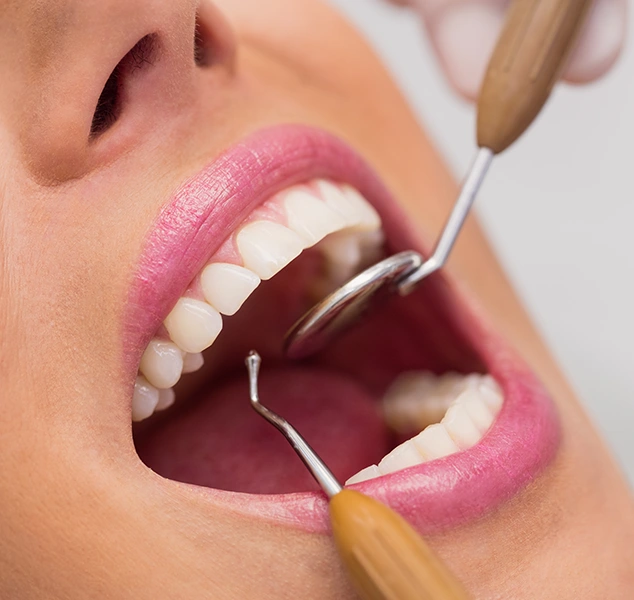 introduction to cosmetic dentistry image